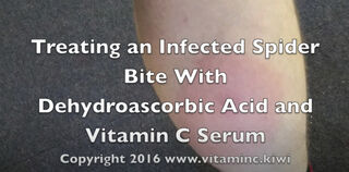 Treating An Infected Spider Bite With DHAA Serum
